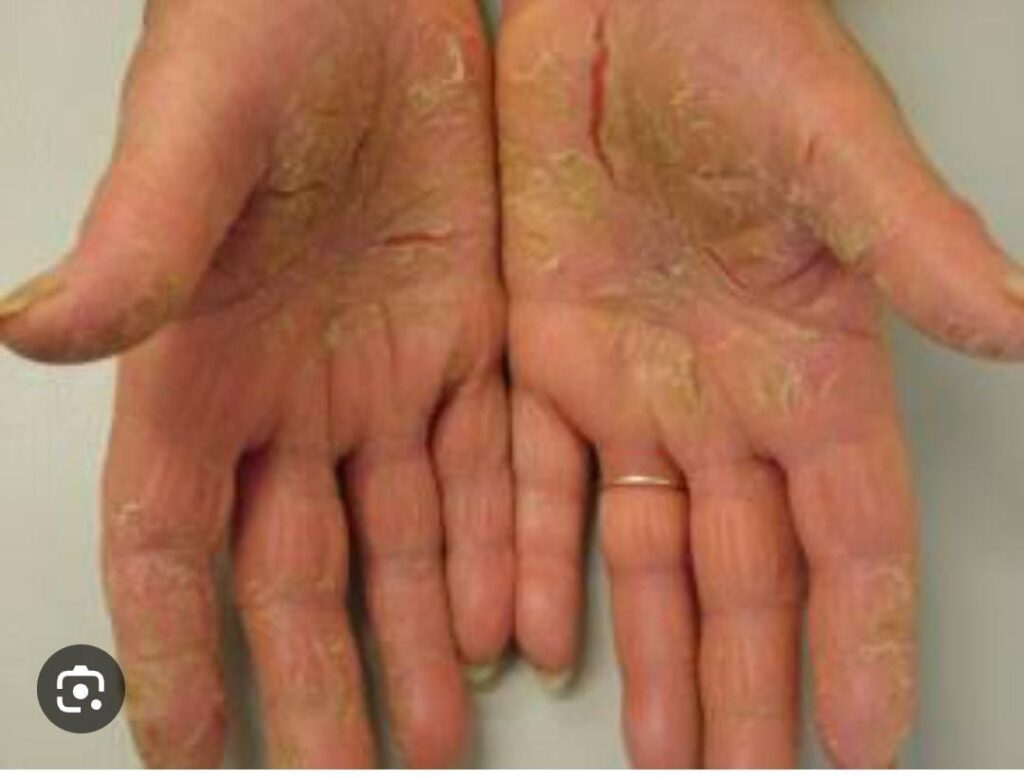 KNR Herbs skin care30