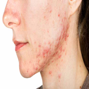 KNR Herbs skin care15
